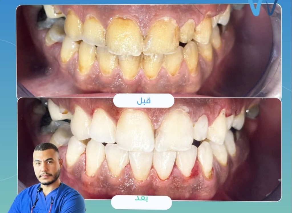 العناية الوقائية المتقدمة