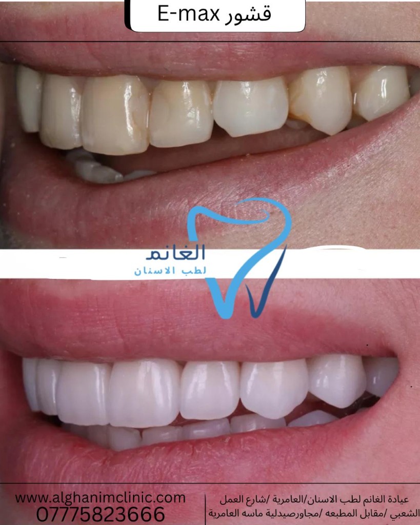 قصة نجاح عيادة الغانم