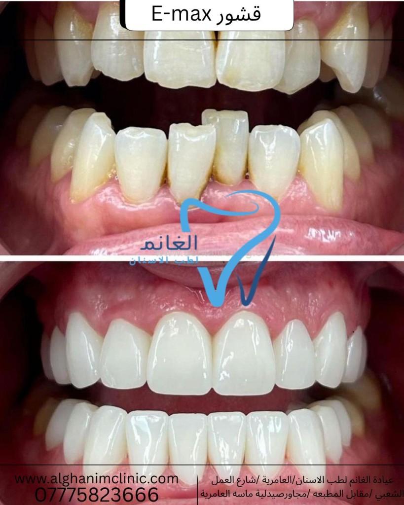 أفضل عيادة ابتسامة في العراق
