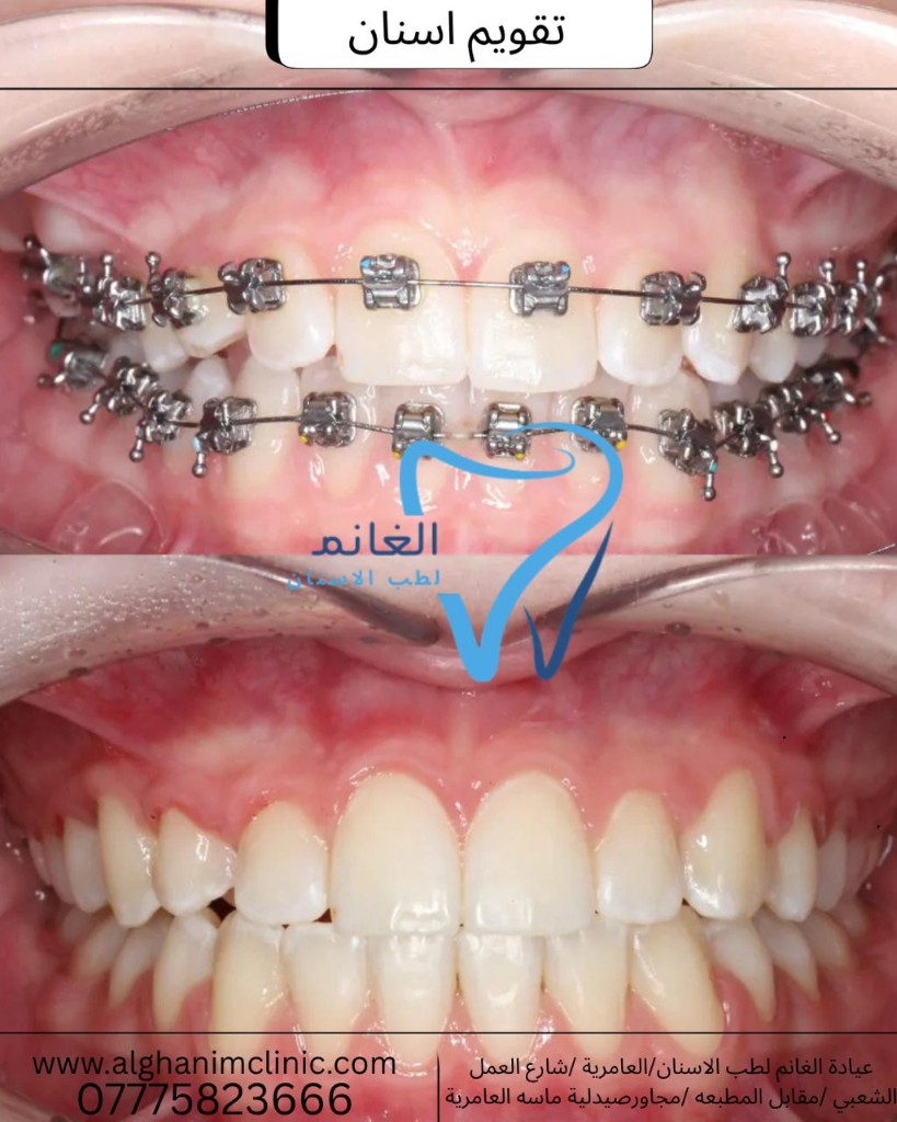 أفضل عيادة تقويم أسنان في الكرخ